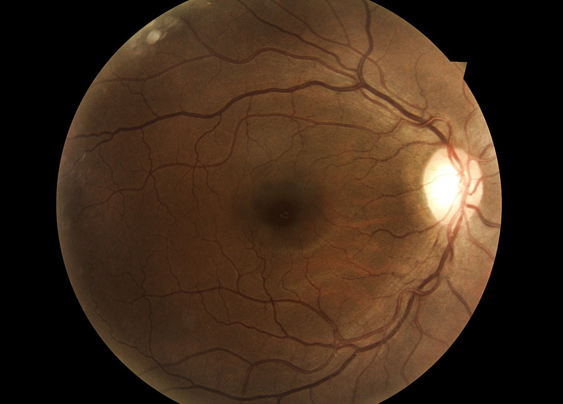 Digital Retinal Fundus Imaging